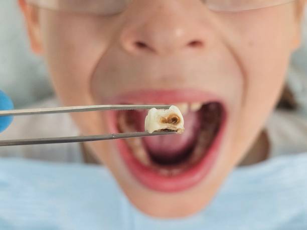 Best Pediatric Emergency Dentist in Elm Grove, WI